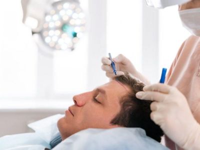 Восстановление линии роста волос после эстетических операций на лице