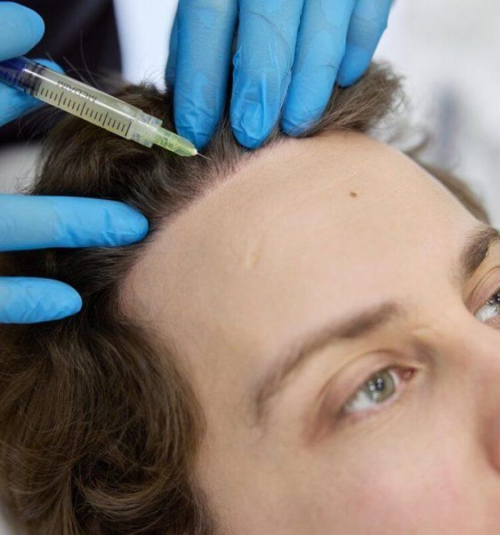 Пересадка волос при очаговой, рубцовой алопеции и после лучевой терапии