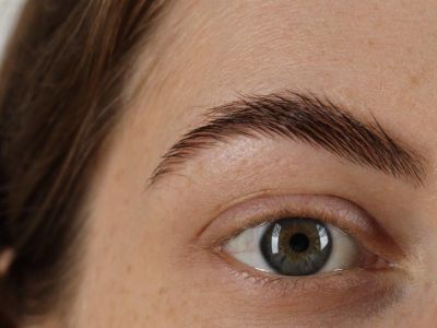 Пересадка бровей